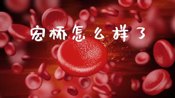 宏桥怎么样了_https://wap.letulww.com_投资管理_第1张